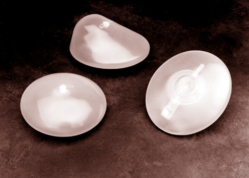 mellplasztika implantátumok